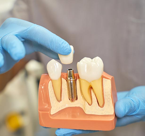 clínica orgaz dental usera