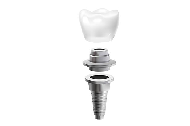 clínica orgaz dental usera