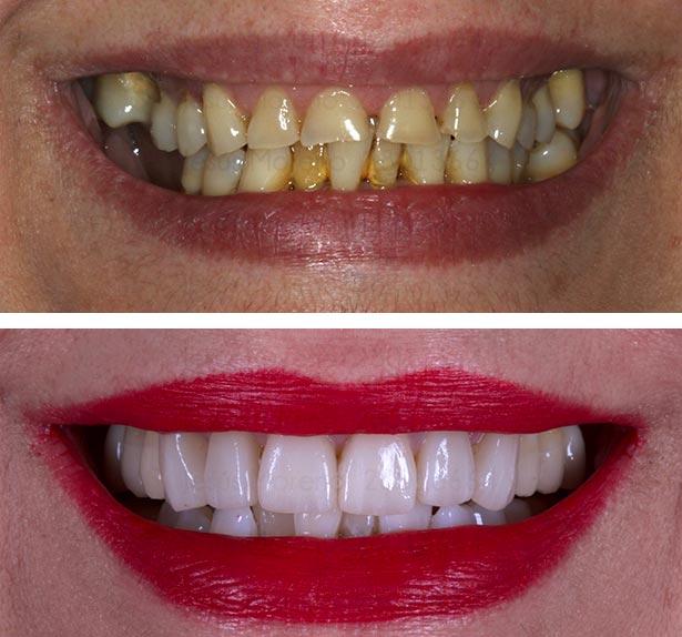 clínica orgaz dental usera
