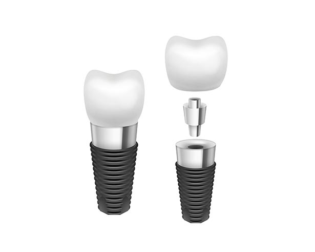 clínica orgaz dental usera
