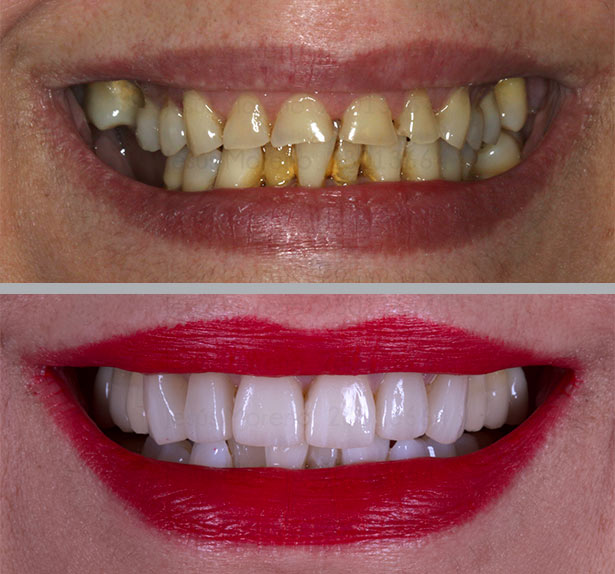 clínica orgaz dental usera