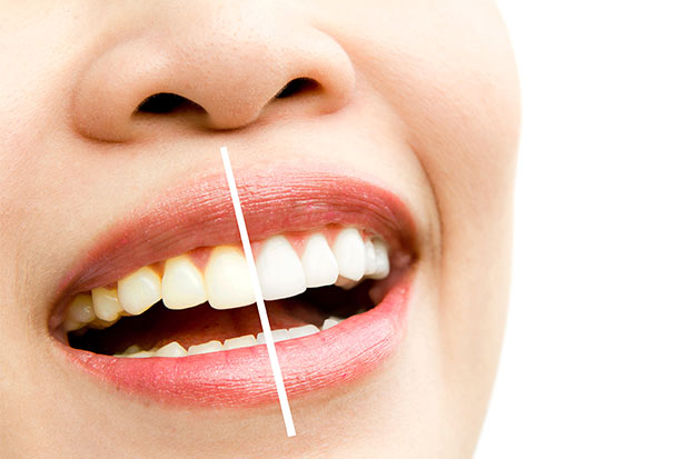 clínica orgaz dental usera