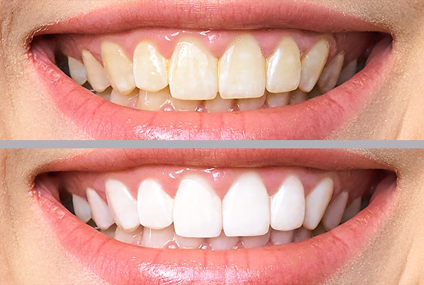 clínica orgaz dental usera