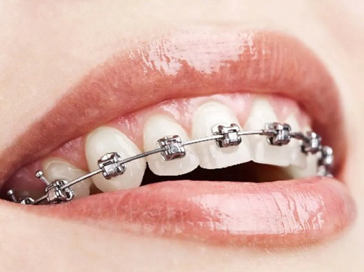 clínica orgaz dental usera