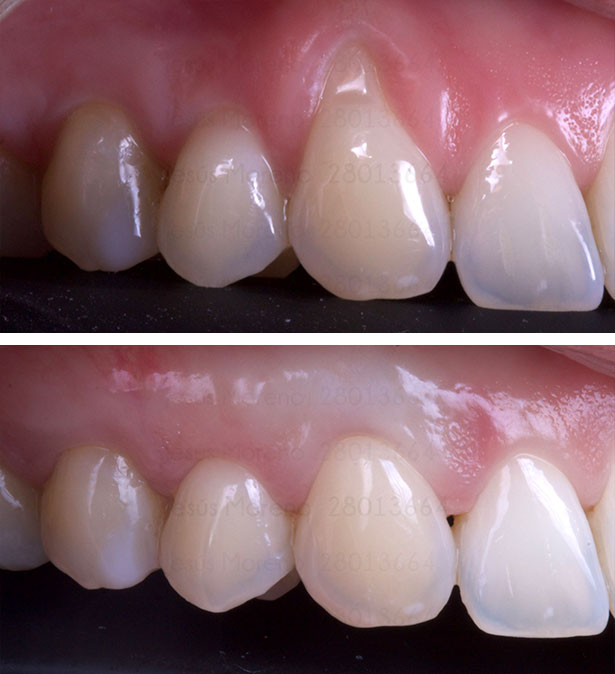 clínica orgaz dental usera