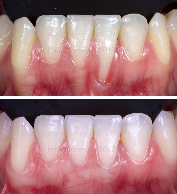 clínica orgaz dental usera