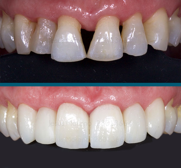 clínica orgaz dental usera