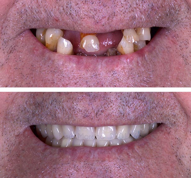 clínica orgaz dental usera