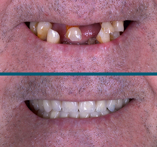 clínica orgaz dental usera