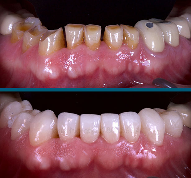 clínica orgaz dental usera