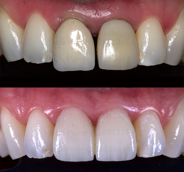 clínica orgaz dental usera