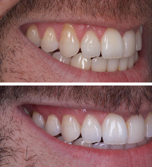 clínica orgaz dental usera