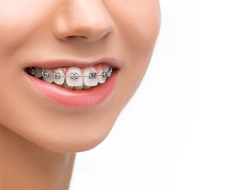 clínica orgaz dental usera