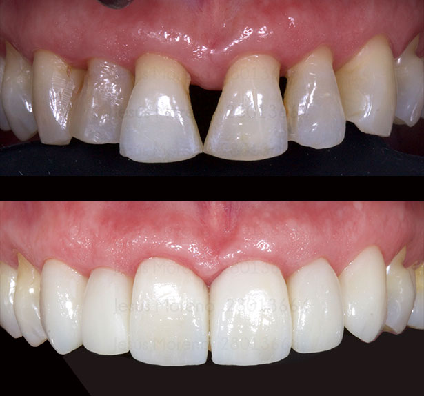 clínica orgaz dental usera