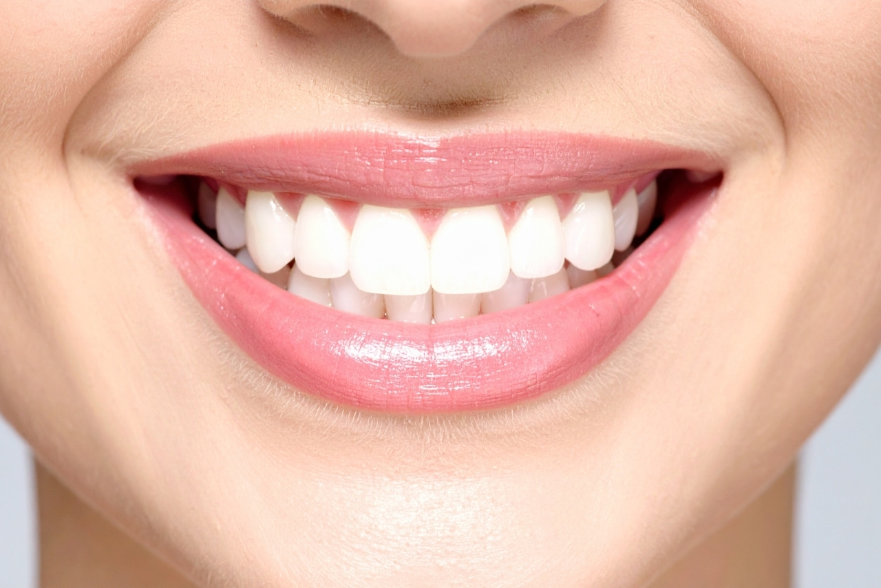 Blanqueamiento Dental y Cuidado Diario: El Camino hacia una Sonrisa Perfecta