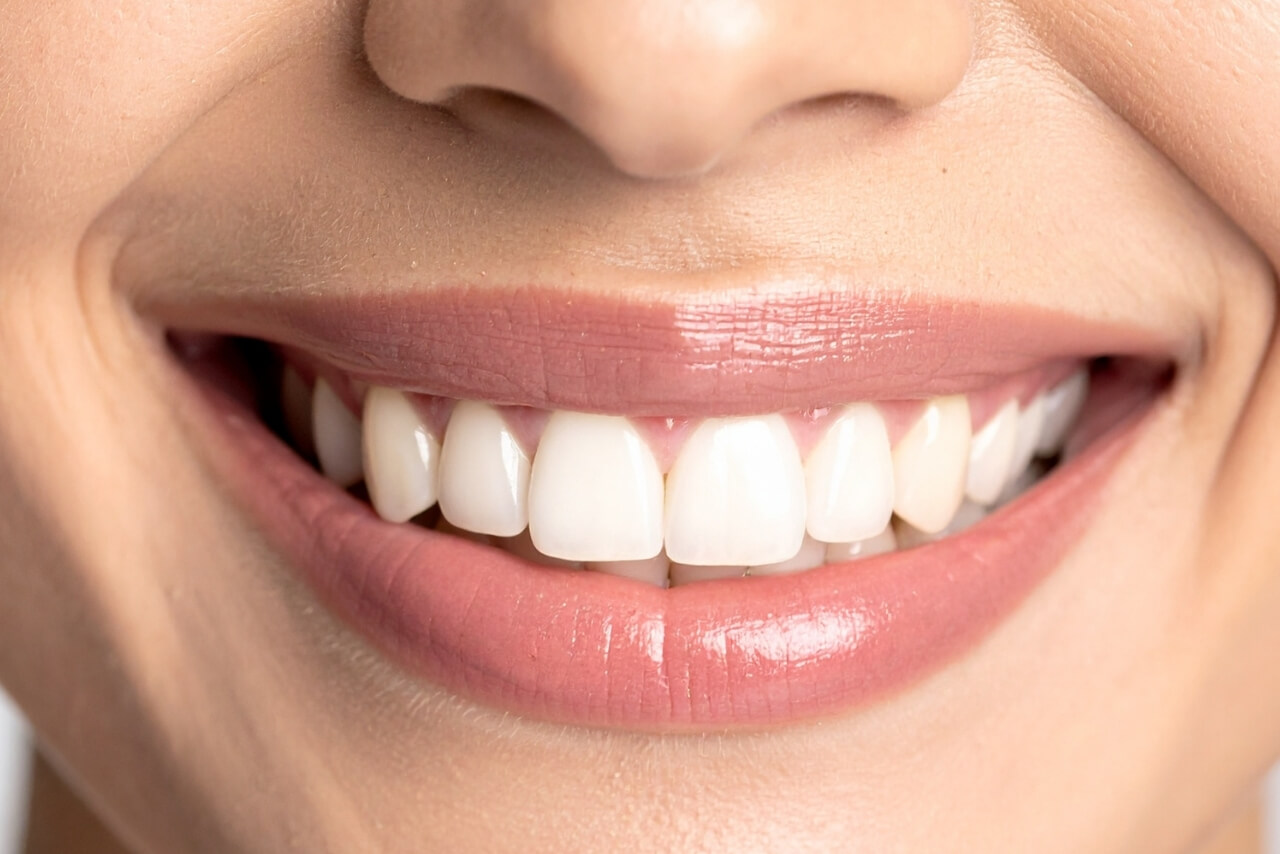 Esmalte Dental: Qué Es, Por Qué Se Desgasta y Cómo Protegerlo