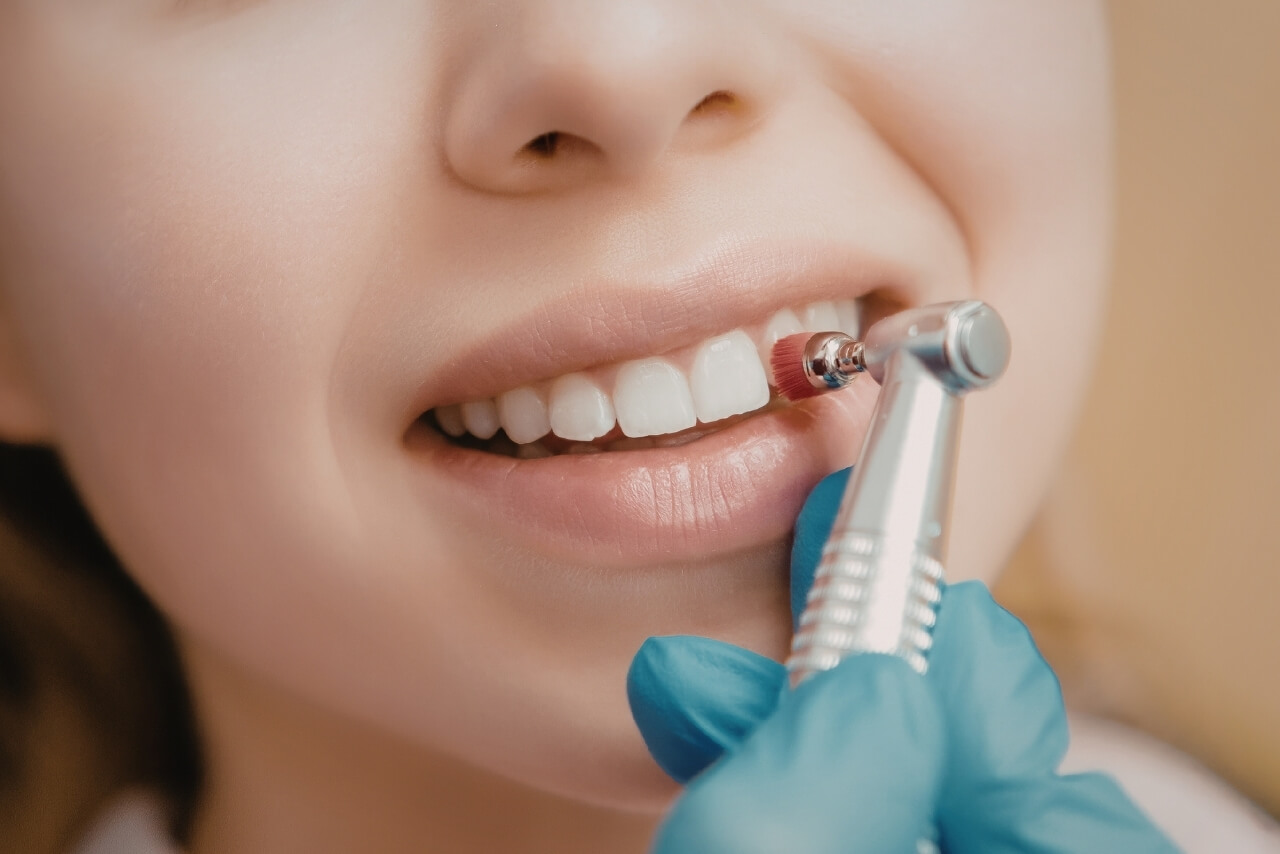 Mucho Más que una Limpieza, la Base de una Sonrisa Sana