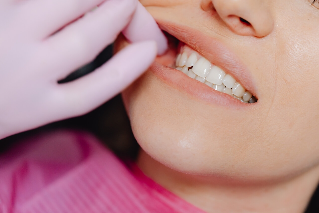 Esmalte Dental: Qué Es, Por Qué Se Desgasta y Cómo Protegerlo