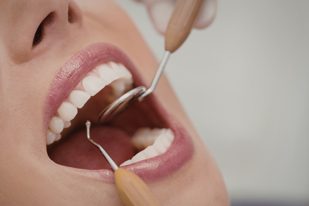 Esmalte Dental: Qué Es, Por Qué Se Desgasta y Cómo Protegerlo