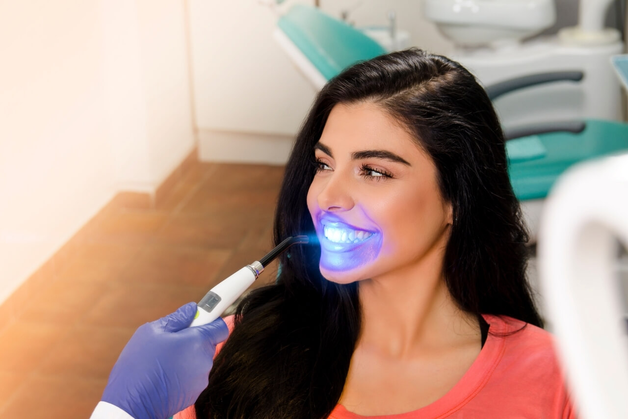Blanqueamiento Dental Profesional: Lo Que Nadie Te Cuenta Antes de Hacerlo