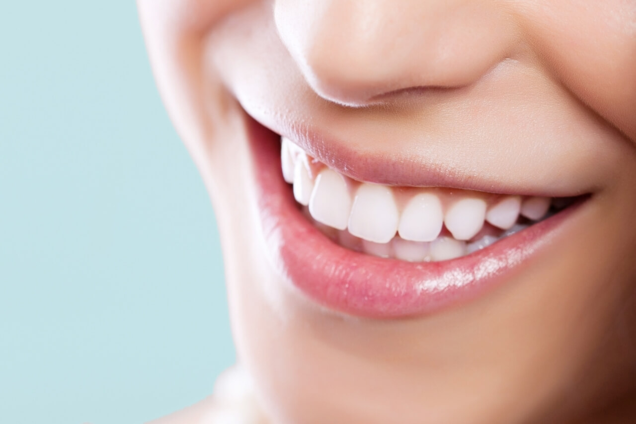 Sonrisa Gingival: Causas, Tratamientos y Cómo Lograr una Estética Dental Más Armónica