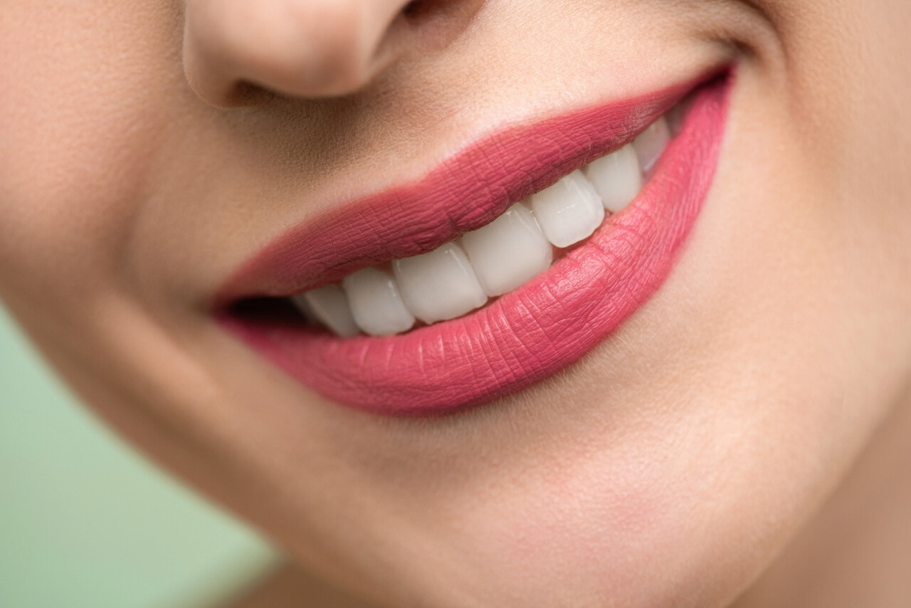 Todo lo que Debes Saber para Conseguir una Sonrisa Más Blanca de Forma Segura