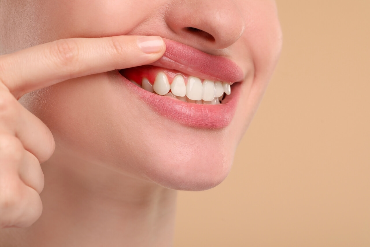 Cómo Prevenir la Periodontitis y Mantener unas Encías Sanas